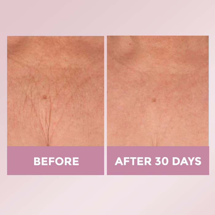 Luxe Skin Lift Cream